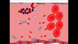 Staphylocccus aureus virulence factors [upl. by Mcnally]