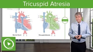 Tricuspid Atresia – Pediatric Cardiology  Lecturio [upl. by Lebyram]