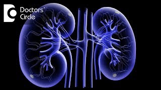 How soon is one discharged amp complications after Lithotripsy  Dr Rajeev Bashetty [upl. by Rusticus]