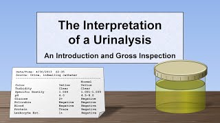 Interpretation of the Urinalysis Part 1  Introduction and Inspection [upl. by Barnebas]