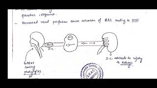 Nephrotic syndromePathology excretory products and their elimination excretorysystem  Ayurveda [upl. by Rainwater]