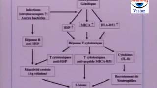 Les Symptômes de la Maladie de Behçet [upl. by Ziul]