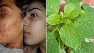 ஒரே இரவில் தடம் தெரியாமல் பரு மறைந்து விடும்  How to get clear spotless skin in tamil  fair skin [upl. by Eeldarb]