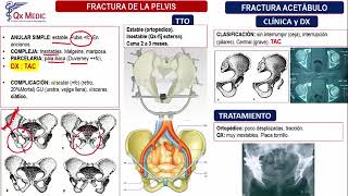 Fracturas Pelvis  Ortopedia y Traumatología Clases Qx Medic  12 [upl. by Dibbrun]