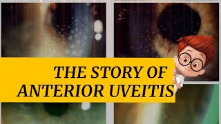 The story of ANTERIOR UVEITIS  iritis cyclitis and iridocyclitis  Signs amp symptoms and more [upl. by Neros15]