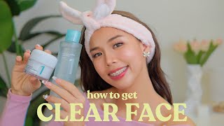 THE BEST SUMMER SKINCARE FOR OILY ACNEPRONE SKIN easy amp effective 💕😳 [upl. by Nahc]