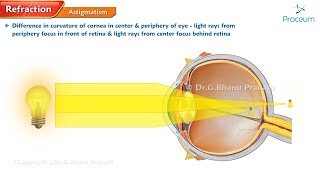 Refractive errors of eye 🌟👁️ Ophthalmology lectures [upl. by Dryden]