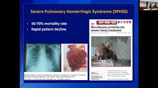 Leptospirosis Clinical Disease and Diagnosis in Humans [upl. by Appledorf403]