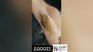 short how to do armpit wax  underarms wax trending viralshort viral ddoozy [upl. by Amatruda]