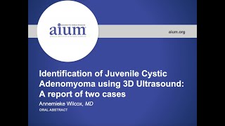 Identification of Juvenile Cystic Adenomyoma using 3D Ultrasound A report of two cases [upl. by Bannister]