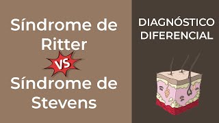 Diagnóstico diferencial Síndrome de Ritter vs Síndrome de Stevens Johnson [upl. by Ibrik]