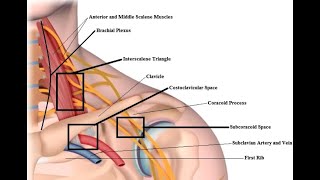 Thoracic Outlet Syndrome TOS vs Cervical Radiculopathy [upl. by Arammat]