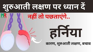 scrotal or inguinal hernia in males symptoms causes treatment in hindi  अंडकोष में हर्निया [upl. by Letha567]