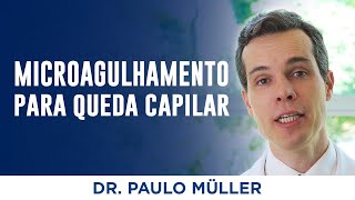 Microagulhamento  Tratamento para Queda de Cabelo – Dr Paulo Müller Dermatologista [upl. by Cardon]