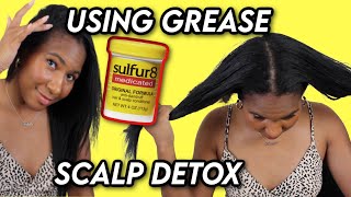 HOW I USE SULFUR 8 GREASE TO GET RID OF DANDRUFF [upl. by Harras]