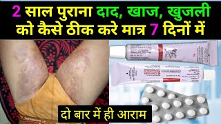 2 साल पुराने दाद खाज खुजली को कैसे ठीक करें  fungal infection in private parts  khujli ki dawa [upl. by Aisenat]