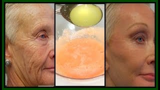 LOOK 5  10 YEARS YOUNGER  ANTI  AGING TOMATO LEMON FACIAL MASK Khichi Beauty [upl. by Enillebyam]