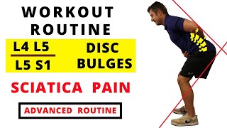 Workout routine for L4 L5  L5 S1 Disc bulges and Sciatica Pain Advanced [upl. by Athal428]