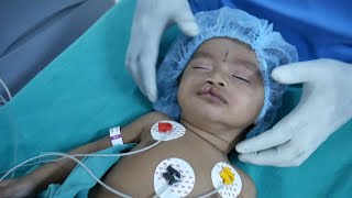 Intubation Procedure for a Pediatric Child by Expert Anesthesia Doctors at Richardsons [upl. by Halonna]