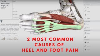 2 MOST COMMON CAUSES OF HEEL AND FOOT PAIN  Orthopedic amp Balance Therapy Specialists  OBTS [upl. by Sirronal]