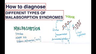 How to get to the most likely diagnosis Malabsorption Syndromes Celiac Whipple and more [upl. by Amato186]