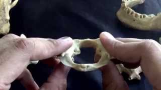 first cervical vertebra  The atlas [upl. by Nenad599]