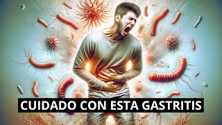 Gastritis Eritematosa Antral TRATAMIENTO 🔥 Síntomas y Causas de la Gastritis Eritematosa Antral [upl. by Earej]