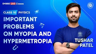 Myopia and Hypermetropia  IMPORTANT PHYSICS PROBLEMS  Class 10 Physics  Tushar Patel  Embibe [upl. by Ani966]