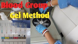 Blood Group Test By Gel Method  Forward Blood Grouping Gel Technology [upl. by Ailis]