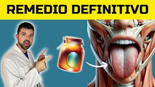 ✅CANDIDIASIS BUCAL ► Descubre como ELIMINAR los HONGOS en la BOCA y la LENGUA 2024 [upl. by Einapets]