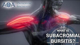 AOA Orthopedic Specialists  Subacromial Bursitis [upl. by Eissirc]