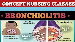 Bronchiolitis causesign symptoms treatment and prevention [upl. by Atikihs]