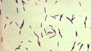 Clostridium perfringens  Wikipedia audio article [upl. by Achilles]