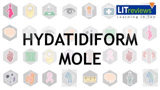 Hydatidiform Mole [upl. by Dyrraj399]