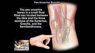 Pes Anserine Bursitis  Everything You Need To Know  Dr Nabil Ebraheim [upl. by Rehpotsihrc793]