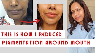 This is How I removed pigmentation around mouth  Get rid of even dullness [upl. by Vallery904]