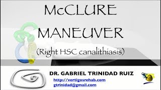 McCLURE MANEUVER RIGHT HSC CANALITHIASIS [upl. by Atauqal694]