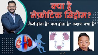 What Is Nephrotic Syndrome  नेफ्रोटिक सिंड्रोम क्या है  Dr Kunal Pai  Pediatric Nephrologist [upl. by Rayna]