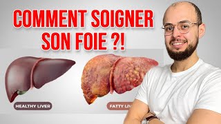 Comment soigner le FOIE GRAS Stéatose hépatique [upl. by Roswald907]