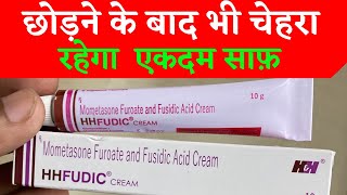 HH Fudic cream  Uses benefits Side effects  For Clean face remove pimple amp acne  Hindi [upl. by Fania117]