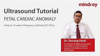 Fetal Cardiac Anomaly study on 14 weeks of Pregnancy by Dr Devang Patel on Mindray DC70 Exp [upl. by Sivrad]