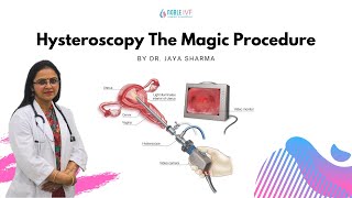 Hysteroscopy The Magic Procedure  DrJaya sharma  Senior IVF SpecialistNoble IVF [upl. by Rifkin]