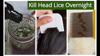 Homemade Hair OIL for Lice amp Nits Removal  KILL HEAD LICE amp NITS Overnight  Sushmitas Diaries [upl. by Heisel]