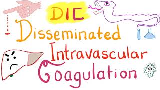 Disseminated Intravascular Coagulation DIC [upl. by Tellford]