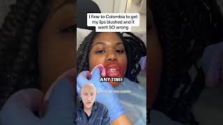 Lip Blushing GONE WRONG  Plastic Surgeon Reacts [upl. by Pedrotti]