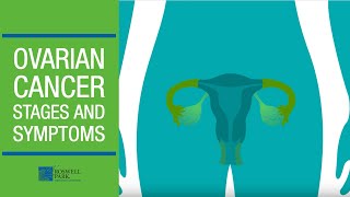 Understanding Ovarian Cancer Stages and Symptoms [upl. by Gavin53]