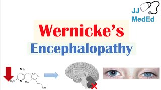 Wernicke’s Encephalopathy  Causes Symptom Triad amp Treatment [upl. by Goldina836]