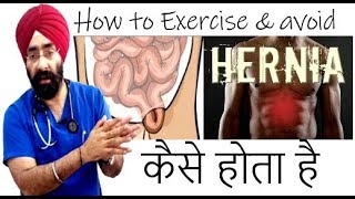 कैसे होता है हर्निया  How to Exercise to Avoid HERNIA  How to Cure  DrEducation Hindi [upl. by Wiggins]