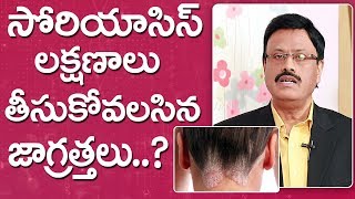 సోరియాసిస్ లక్షణాలు తీసుకోవలసిన జాగ్రత్తలు  Psoriasis Symptoms amp Treatment Tips Dr Madhu Varanasi [upl. by Shellie896]