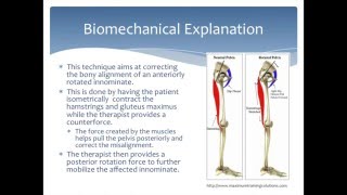 Mobilization to correct an Anterior Innominate rotation of the pelvis Physical Therapy [upl. by Nimrak]